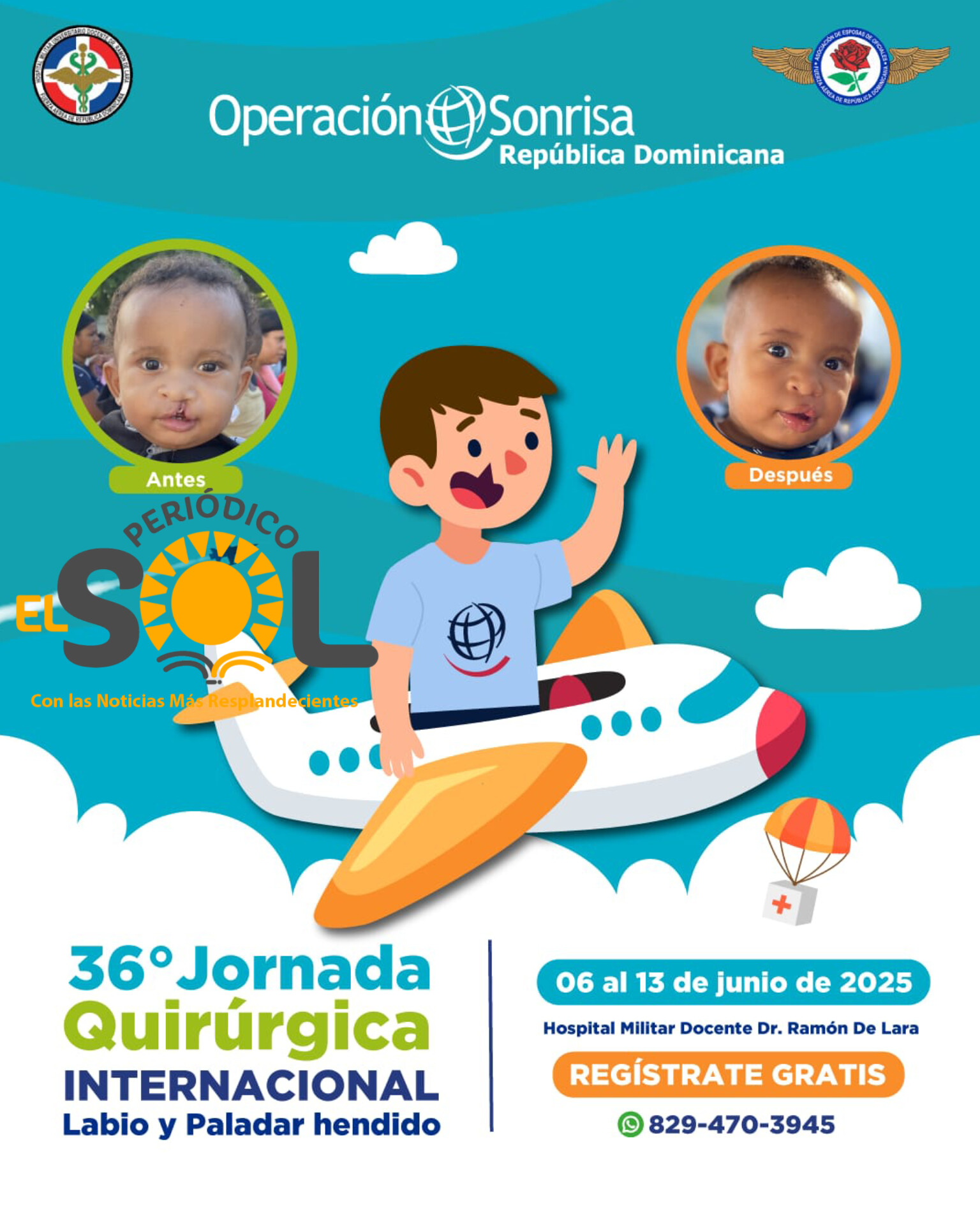 Fundación Operación Sonrisa República Dominicana realizará jornada quirúrgica gratuita de Labio y Paladar Hendido